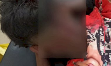 বোকাখাতৰ ডিফলু পথাৰত নাহৰফুটুকীৰ আক্ৰমনত কিশোৰ আৰু বনকৰ্মী আহত  :